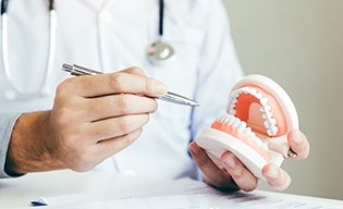 Tökéletes mosoly All-on-4 teljes fogív pótlással