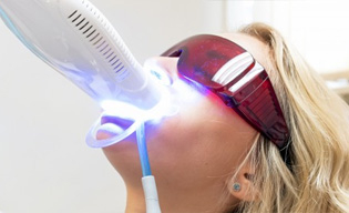 Rendelői fogfehérítés - egy árnyalat is számít